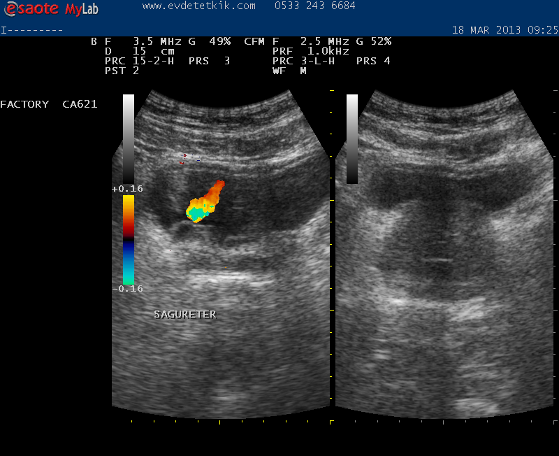 evde ultrason 02